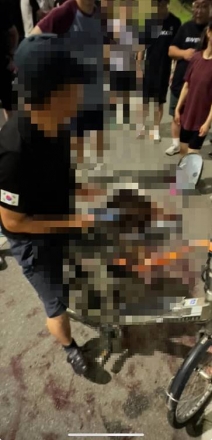 천안 전기자전거 보더콜리 학대, 끝내 죽음으로…市·경찰 ‘뒷북 대응’ 논란