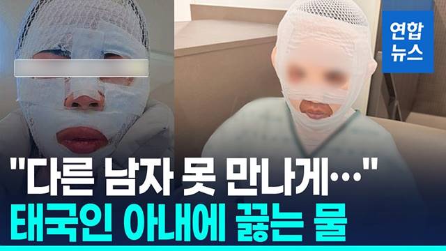 “다른 남자 만날까 봐”…태국인 아내 얼굴에 끓는 물 부은 40대 검거